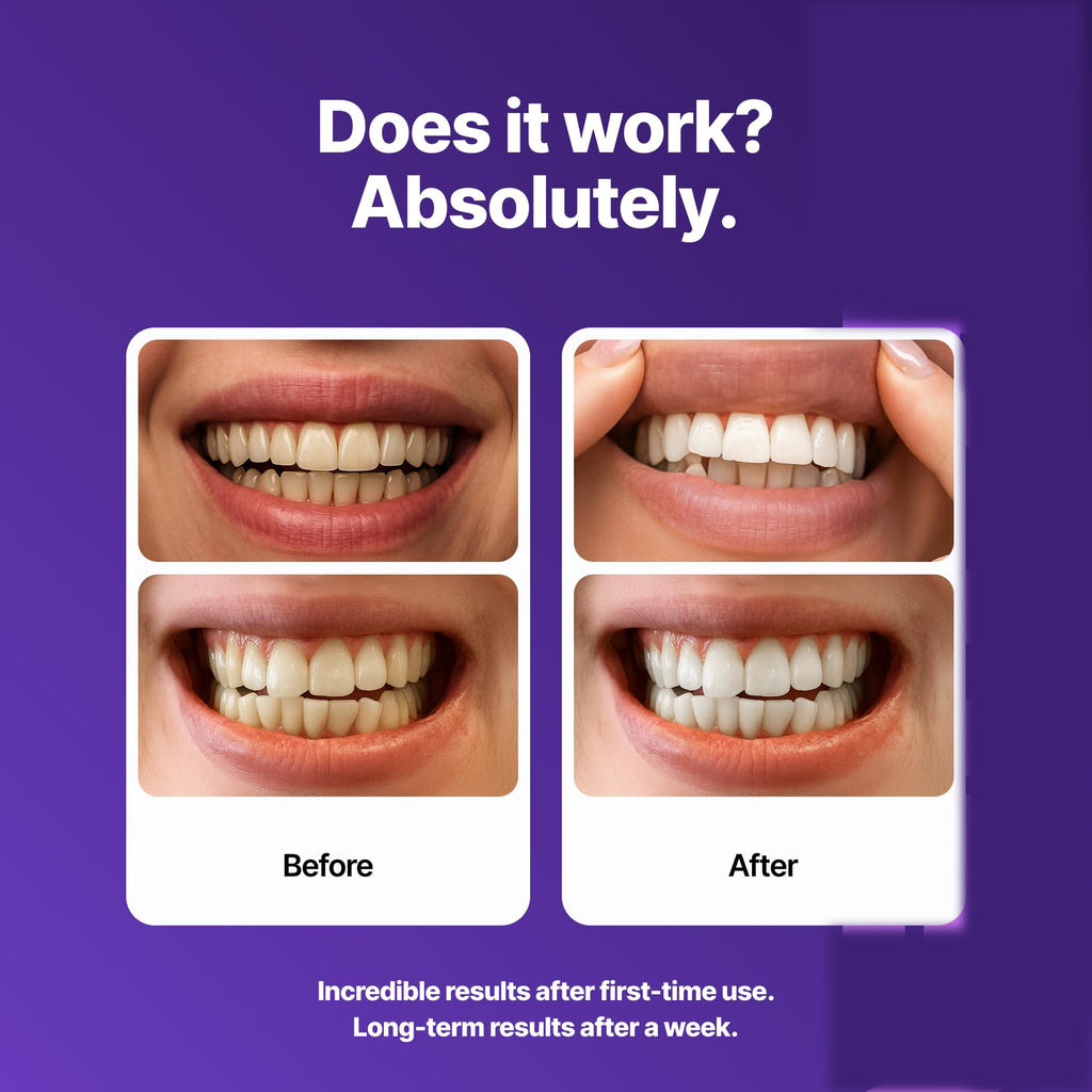 Purple Teeth Whitening Strips | Easy At-Home Stain Brightening
